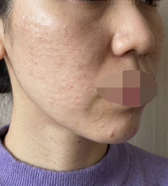 받은 지 1일인데 벌써 효과 보여서 만족이에요~