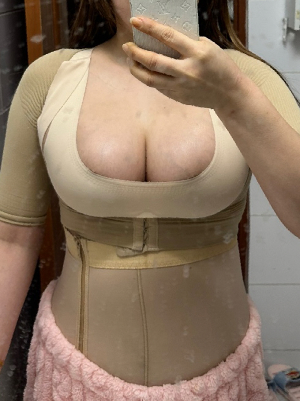 가슴 지방이식은 대대대대대!! 만족♥♥♥