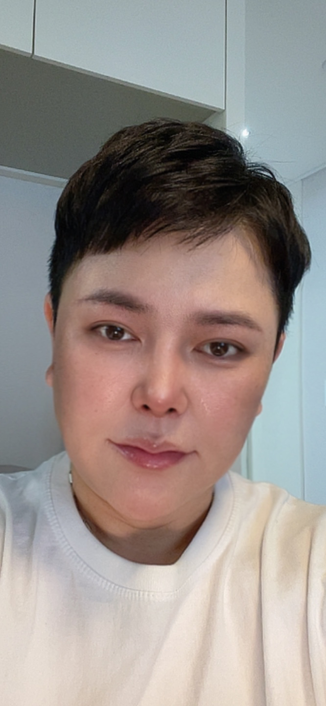 1달차 붓기는 현재 살짝있고 코움직임에 불편함도없고 우선코모양이 너무맘에듭니다