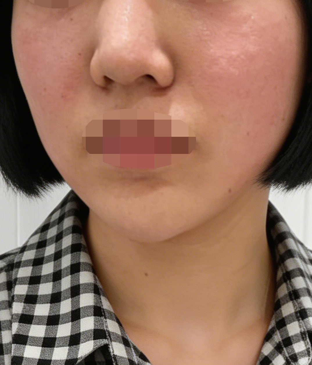 피부 속이 비어있는 느낌이었는데 리즈네 받고 바로 촉촉해진 느낌이 들어요~!