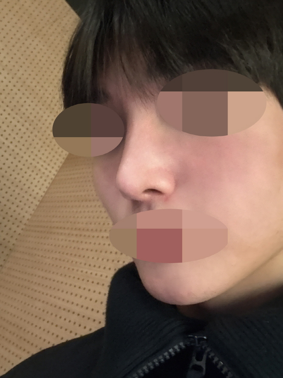 이젠 걸을 때 땅을 보고 걷지 않아도 되네요.. 정면보며 당당히 걷는 게 너무 행복해요