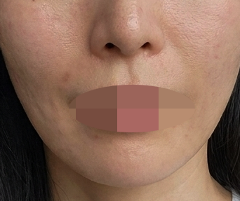 데스크부터 의사 선생님까지 모두 신경 써 주셔서 매번 만족이에요ㅎㅎ