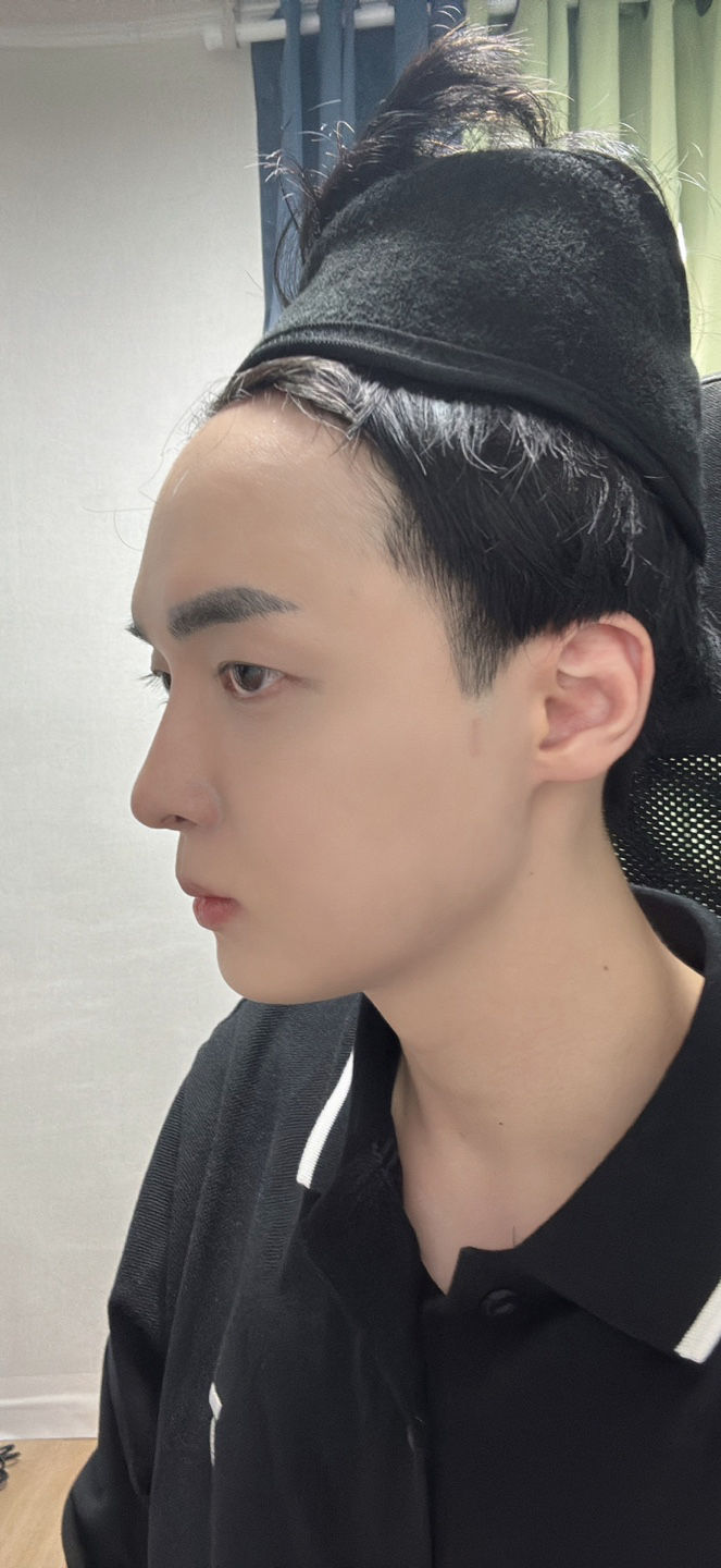 너무 경과가 좋게 나와 매우 만족스러워