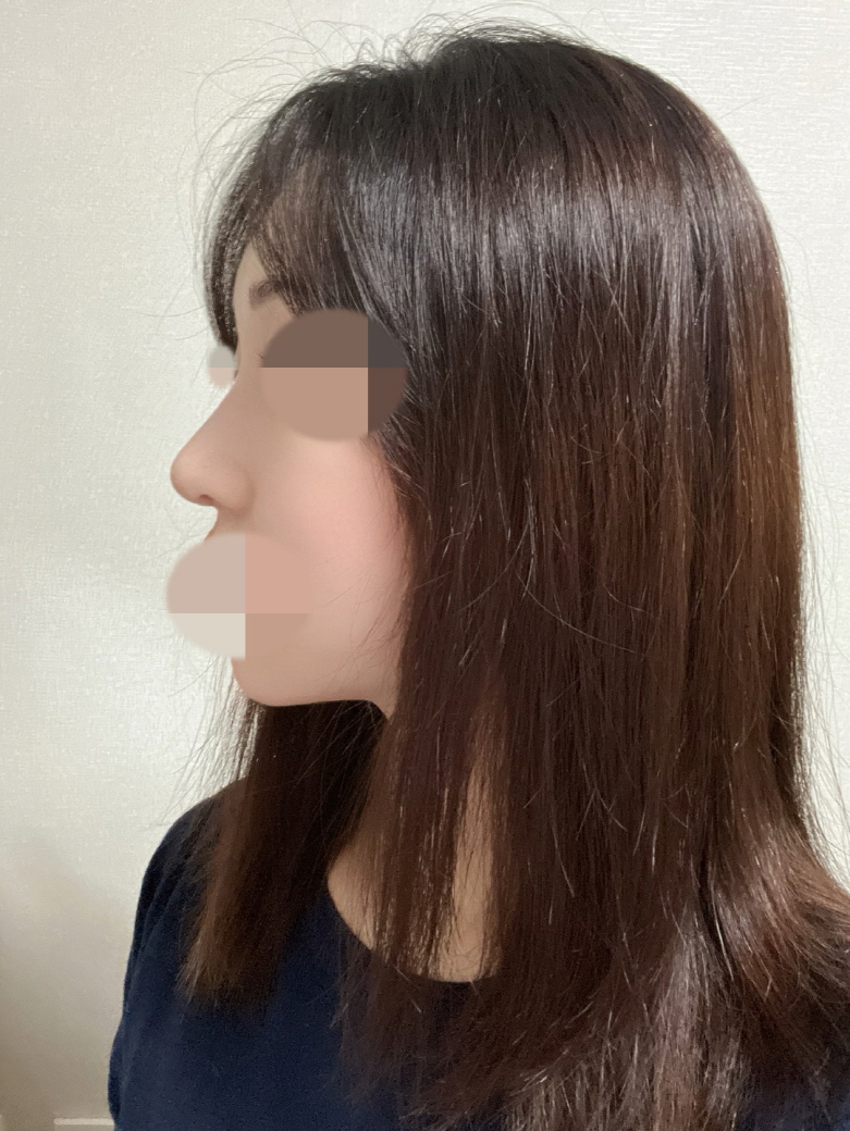 주변에서 자연스럽게 예쁘다고 하고 저도 너무 만족합니당 !