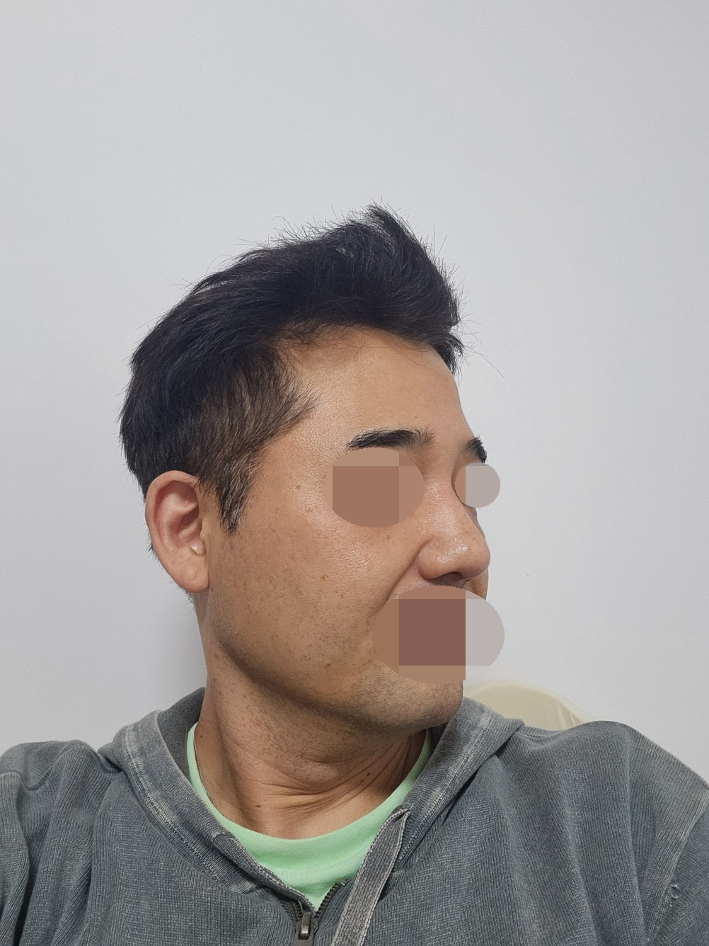 불편한것도 없고 얼른 붓기 빠지면 더 만족스러울거같습니다