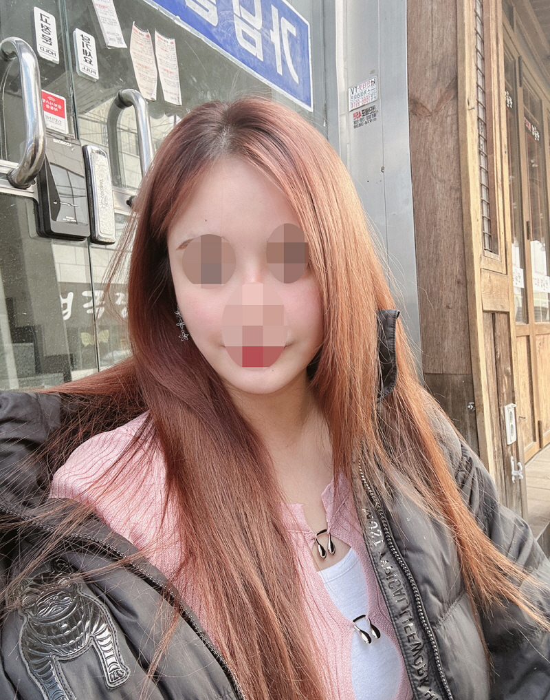 원장님이 너무 꼼꼼한 스타일이셔서 안심햐구 수술 받았어요ㅎㅎ 이중턱 없어져서 너무 만족하구있어용