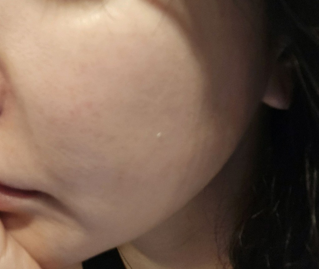 슈링크 상담 받았는데 강요 없이 원하는 것만 해줘서 편했어요 ㅎㅎ
