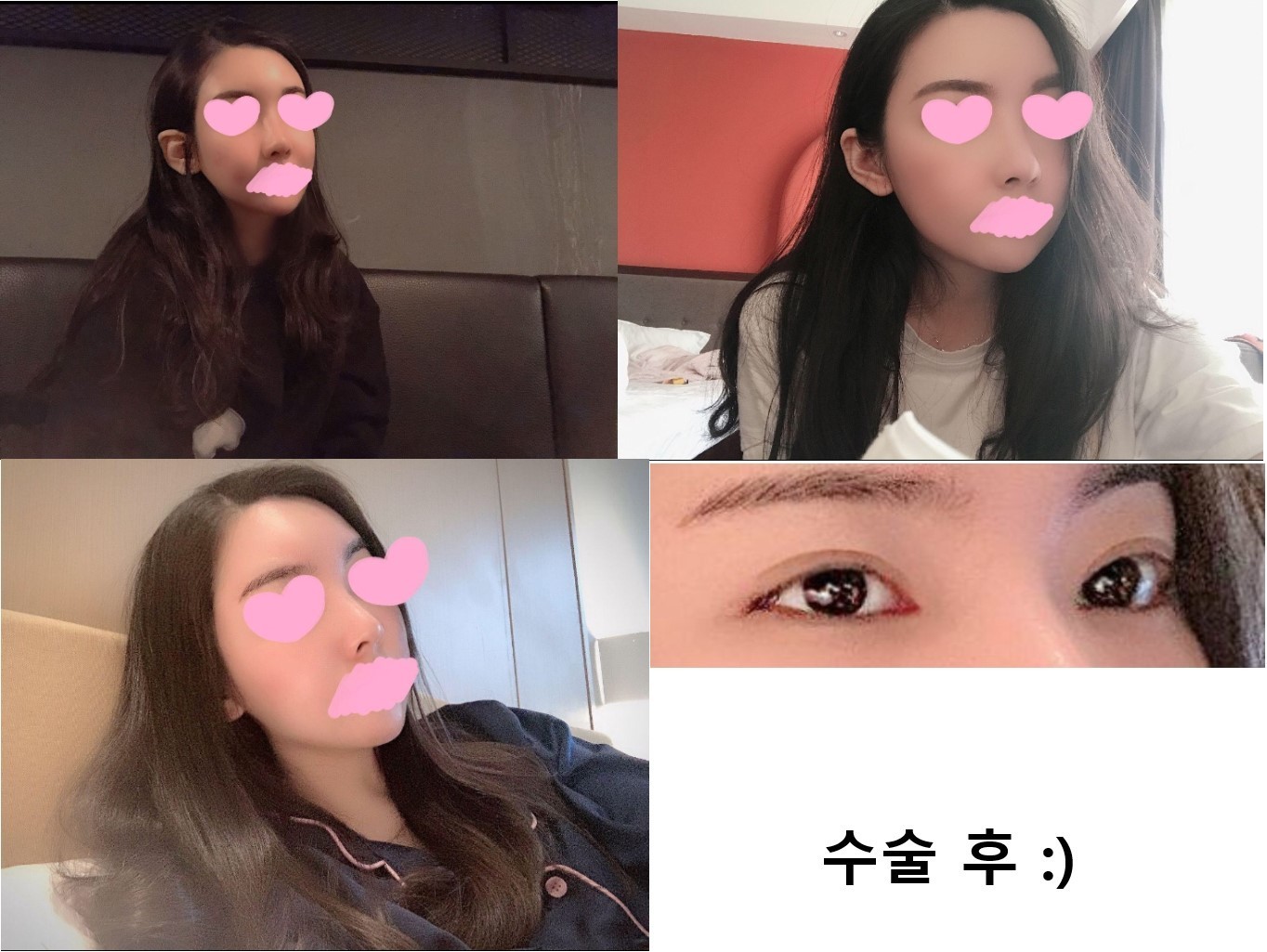 눈코지 후기_!