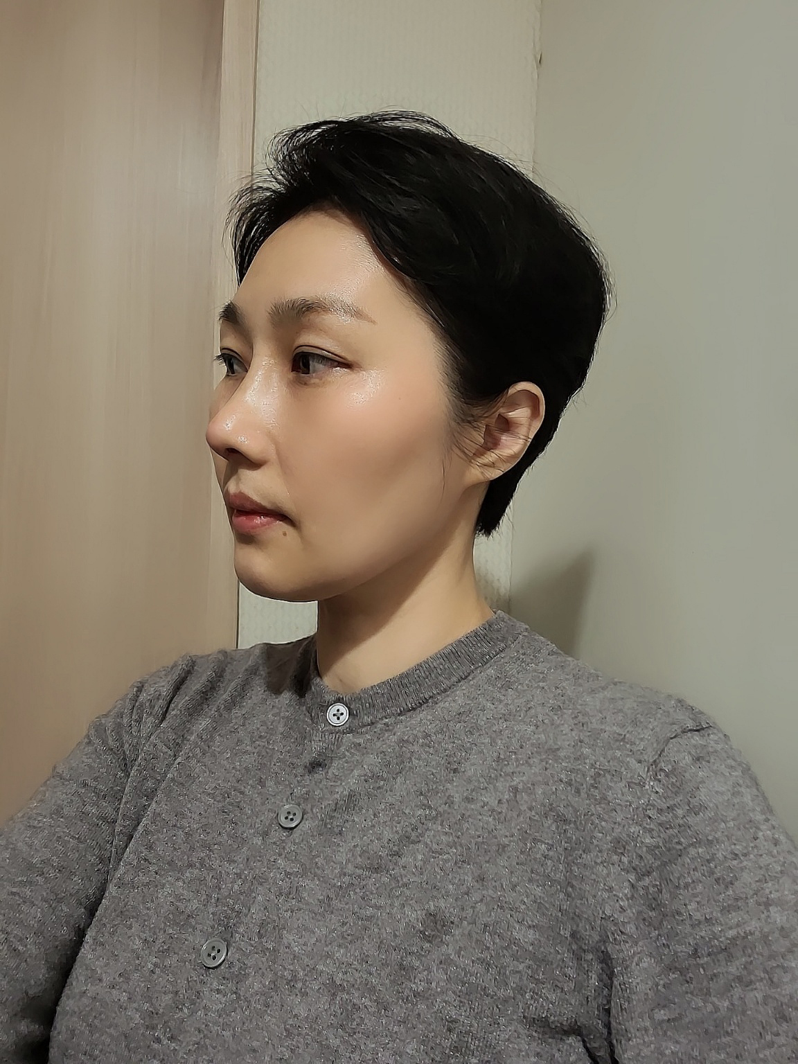 코 성형수술 수술받게 되었어요