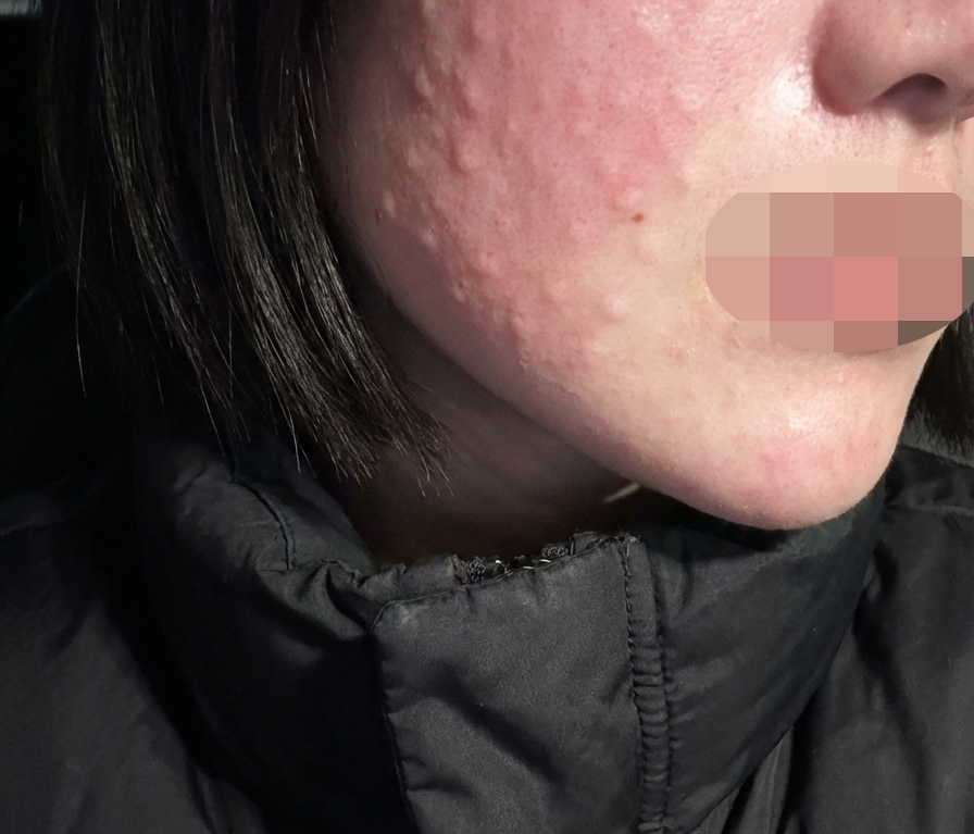 긴장하고 갔는데 다들 친절해서 편하게 받은 것 같아요 ㅎㅎ