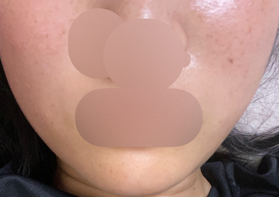 윤기 있는 피부 만들고 싶어 방문, 친절한 응대 덕분에 만족스러웠어요~