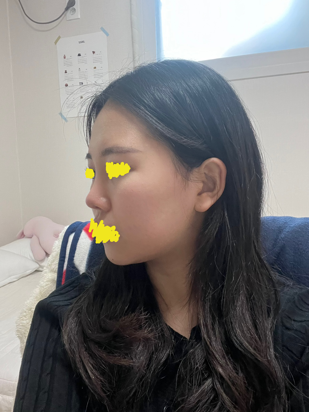 왜이렇게 잘됐냐고 ᅲᅲ 엄청 자연스럽고 티 하나도 안난다고 합니당