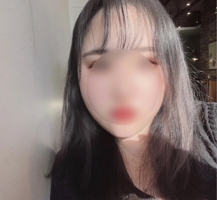 [지방흡입] 3개월차 후기