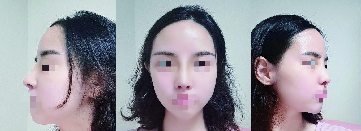 드디어 수술했습니다~