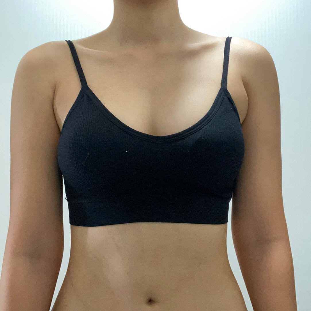 세심하게 케어해주셔서 좋았고 내 가슴같이 자연스럽게 커져서 전체적으로 만족해요~!