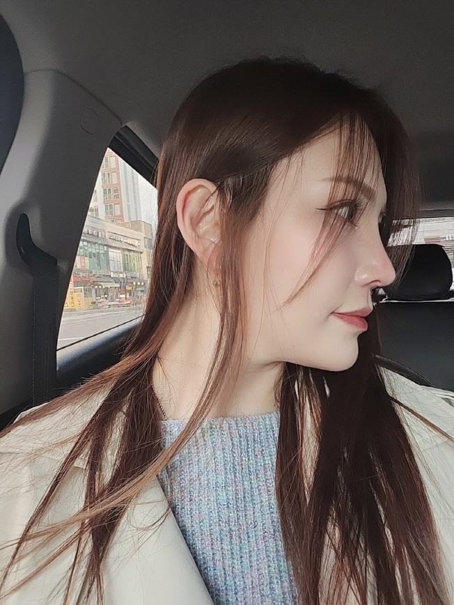 황정일 원장님 예쁘게 코 수술해주셔서 감사합니다^^