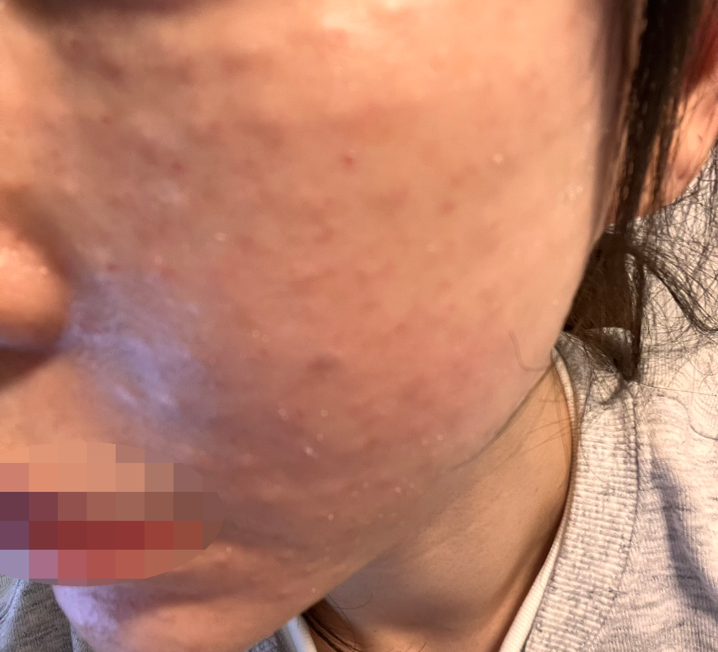 리즈네 받았는데 건조함 잡히고 친절해서 좋았어요 ㅎㅎ