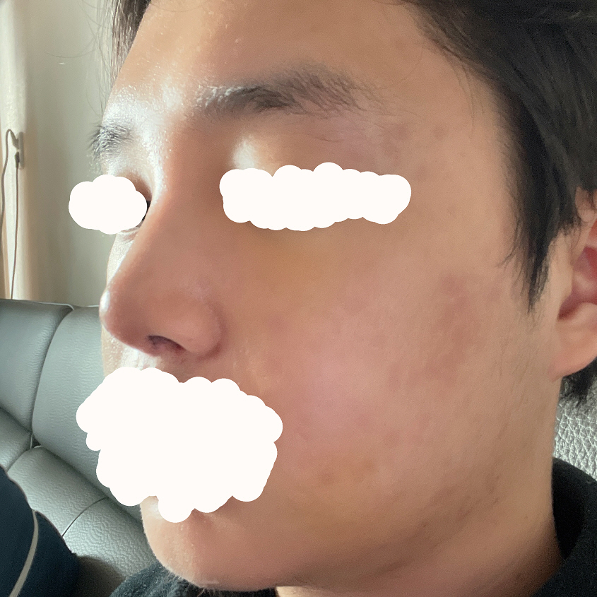 수술 잘된거 같습니다.