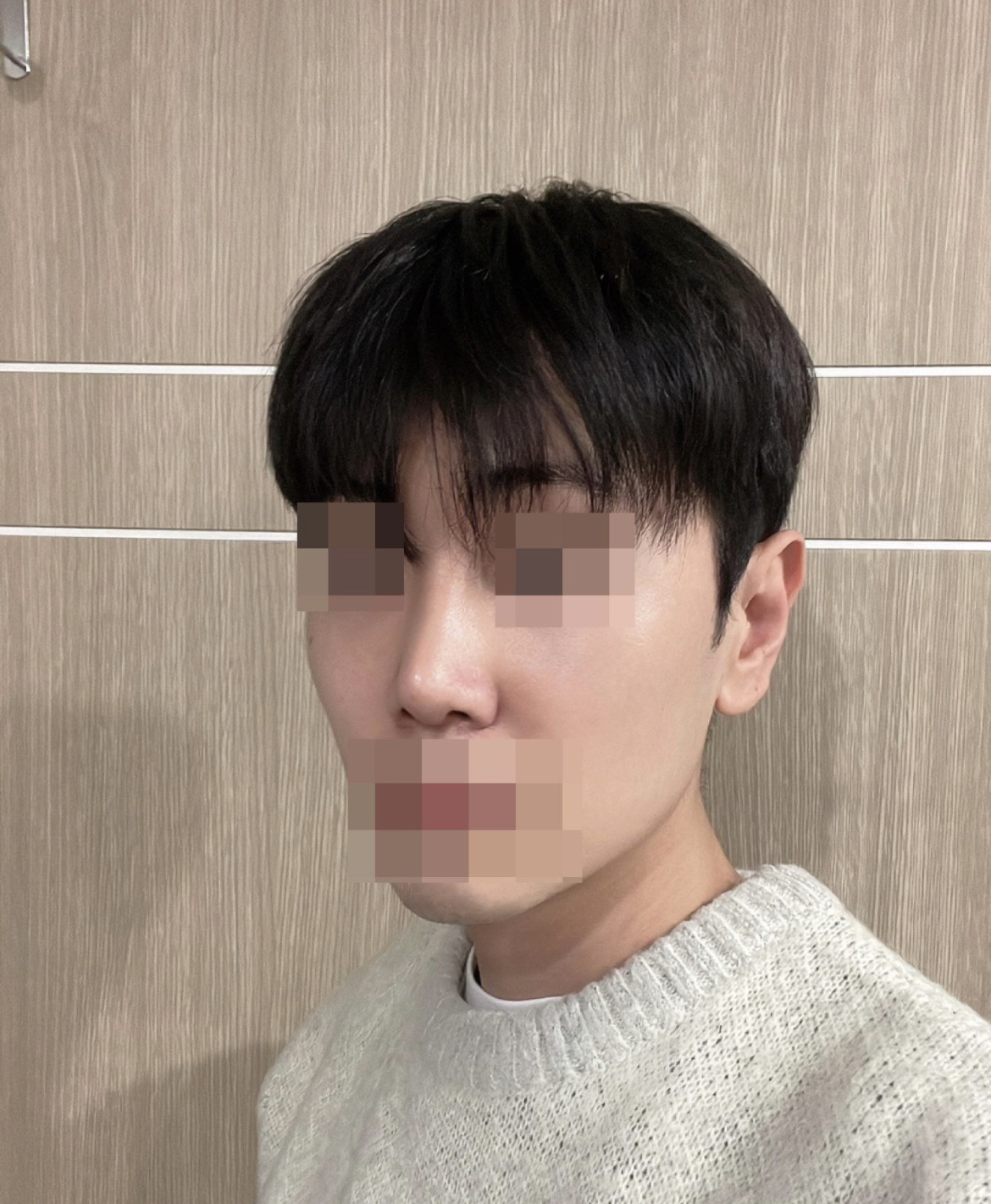수술하길 정말 잘 한것 같아요 감사합니다.