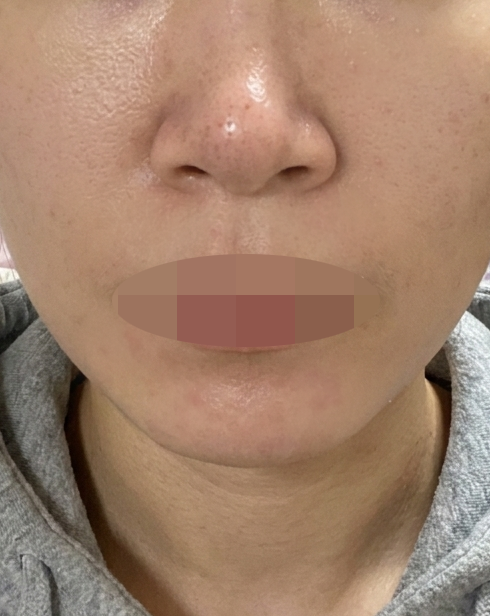 직접 알아보고 결정한 샤넬주사, 친절한 응대까지 만족이에요ㅎㅎ