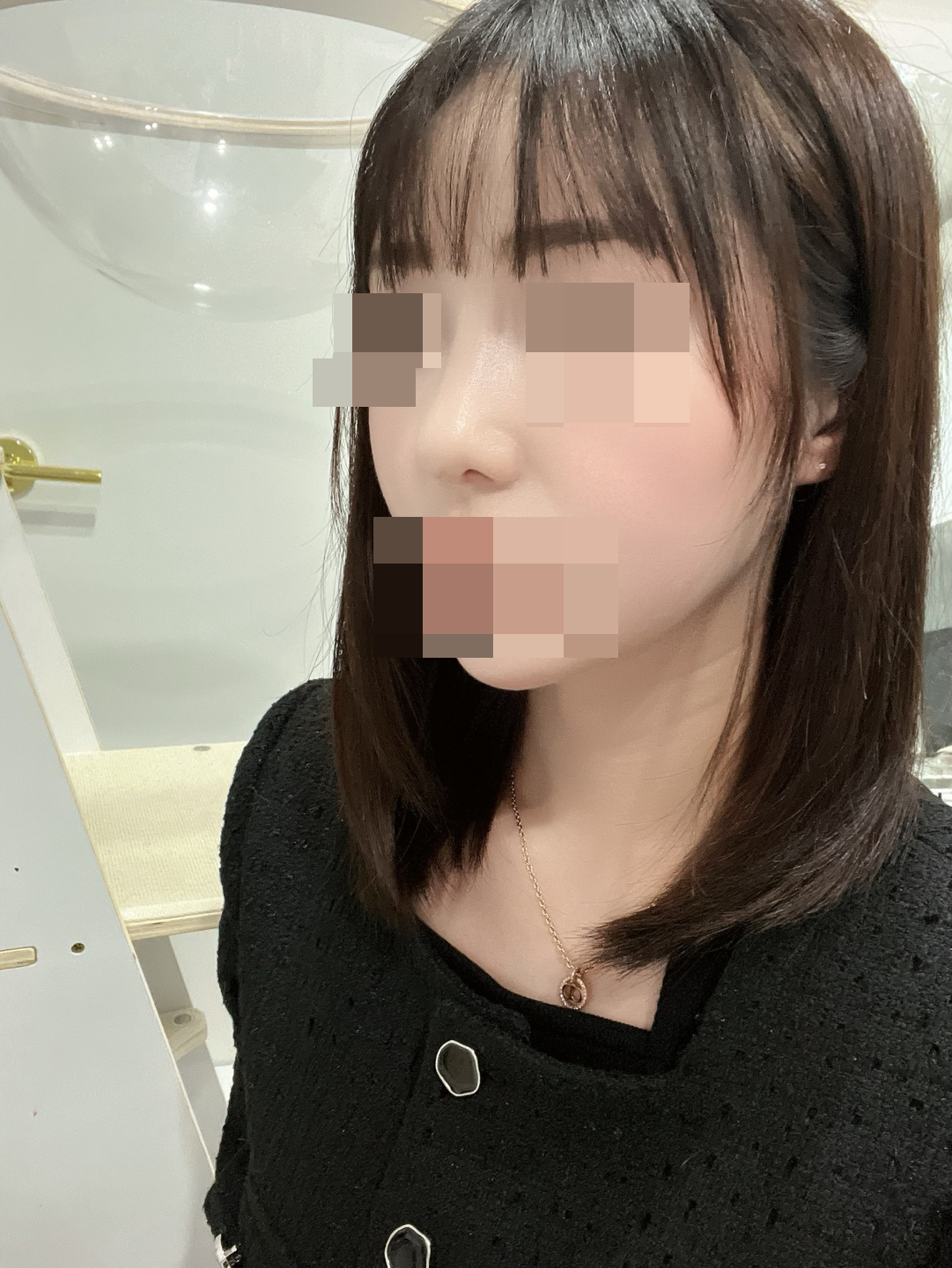 붓기가 잘 빠지고 있어요