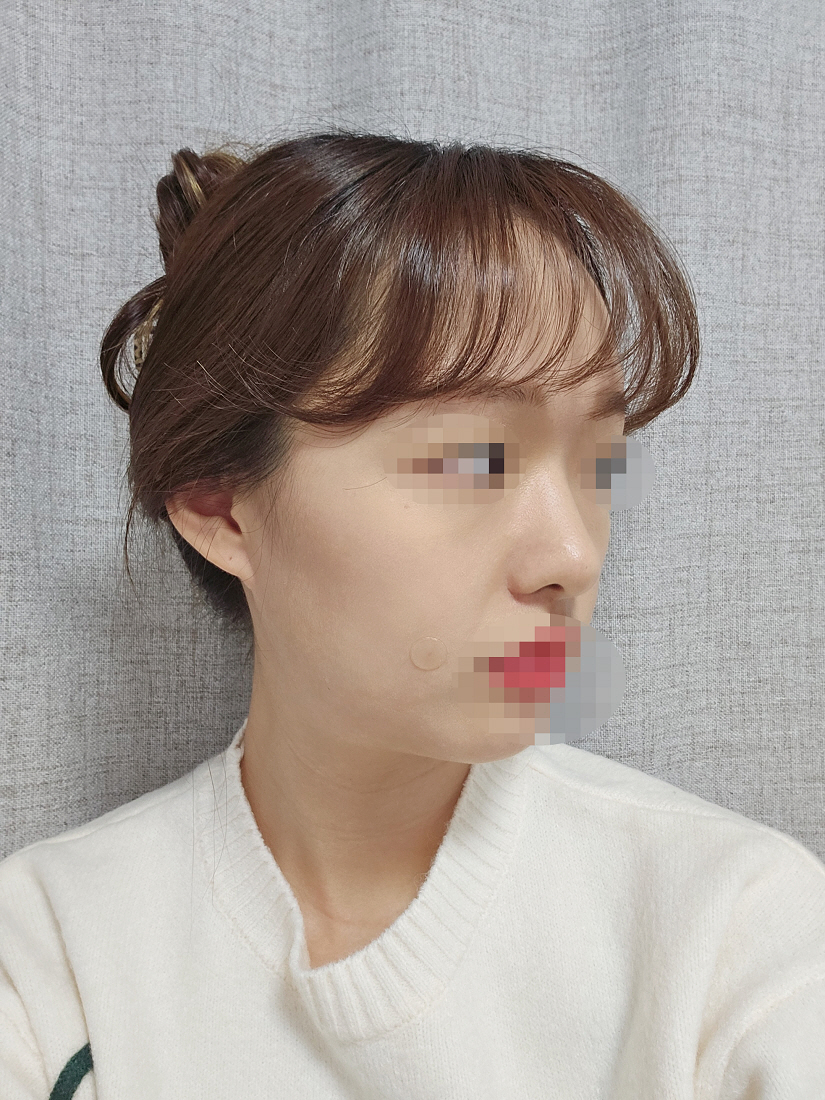 저도 모르는 잔붓기가 있었는지 점점 더 예뻐지고 있어서 기분이 좋아요ᄒᄒ