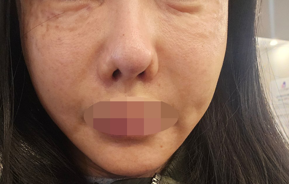  눈밑 건조했는데 받고 나니까 바로 좋아지고, 친절하고 꼼꼼해서 항상 여기만 다니는 것 같아요~