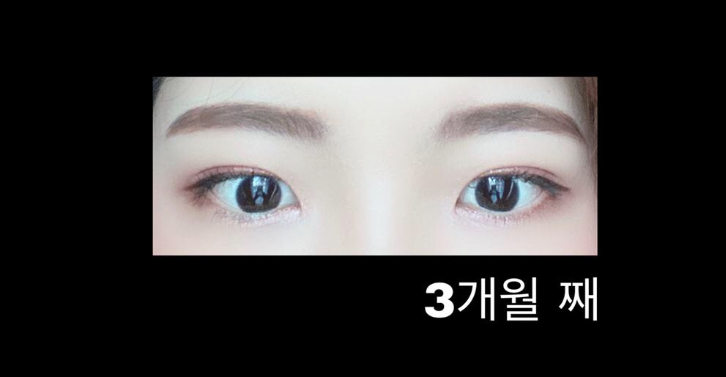 자연유착 후기예여