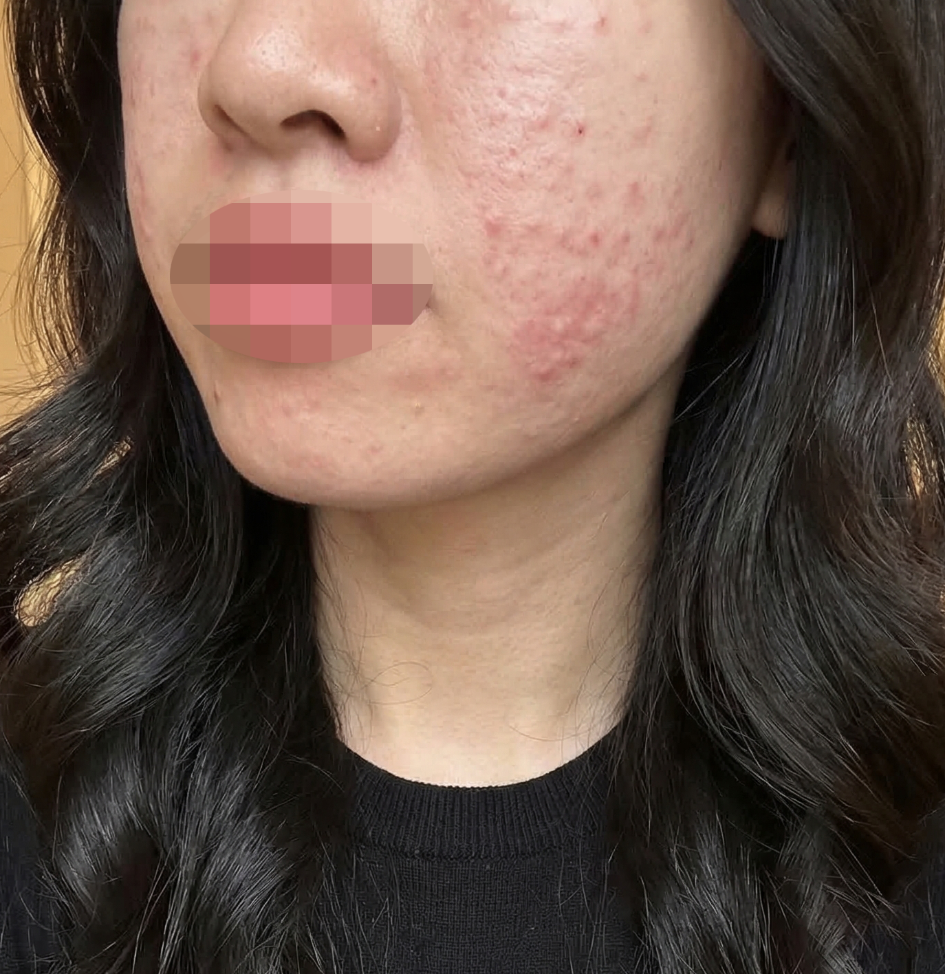 일본어 통역 가능하고 리쥬베룩 받아서 효과 기대돼요~