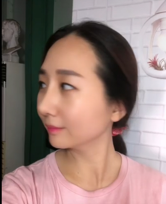코 모양이 마음에 들었습니다 수술은 잘 되었습니다^^