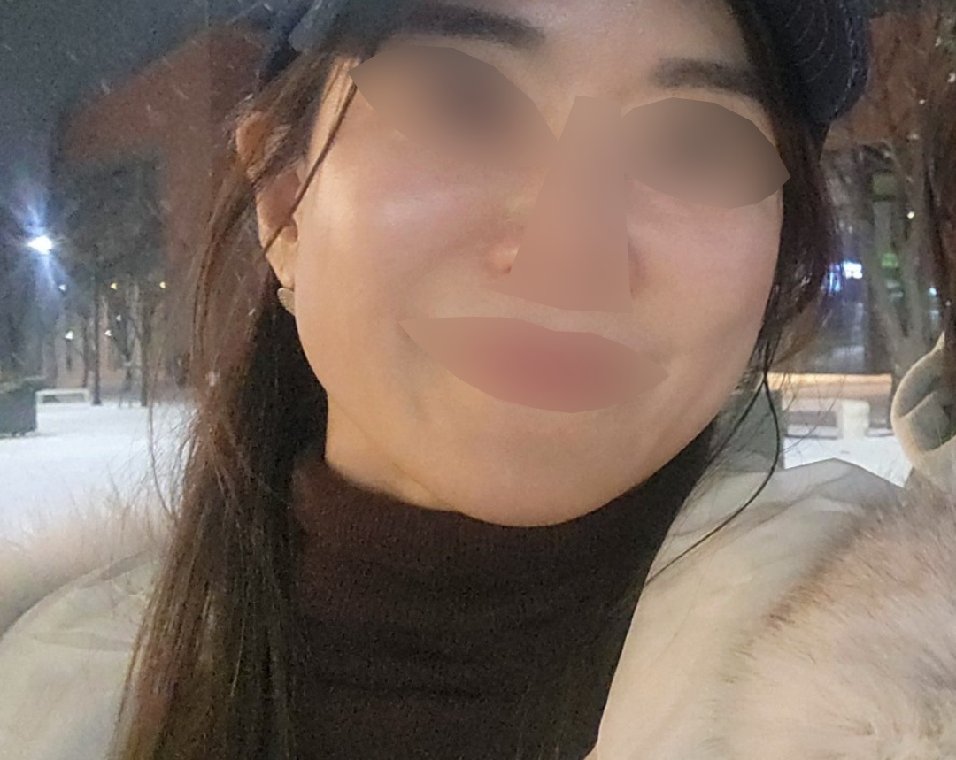 푸석한 피부가 신경 쓰여서 받았어요