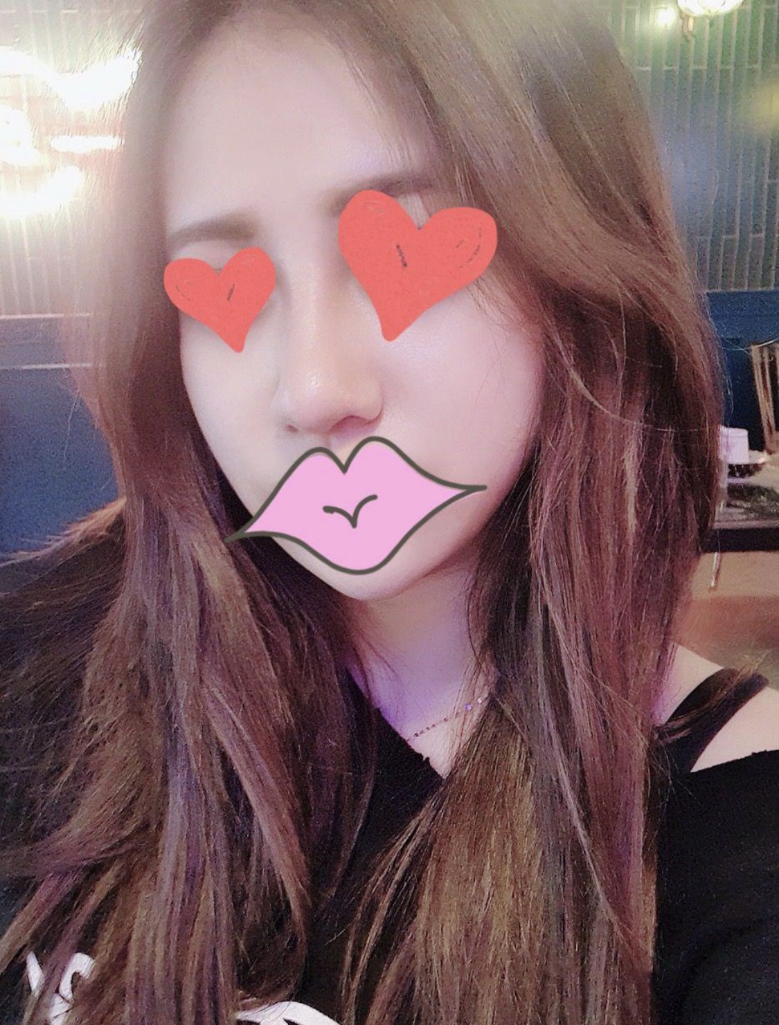 황정일 원장님 수술 후기
