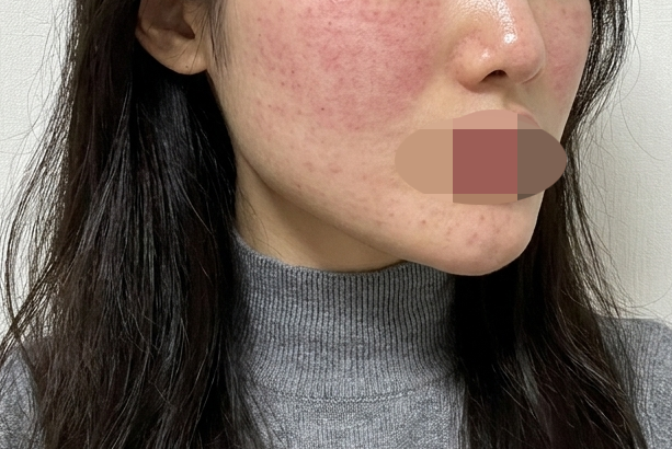화장할 때마다 스트레스던 피부, 리쥬베룩으로 케어 시작했어요~