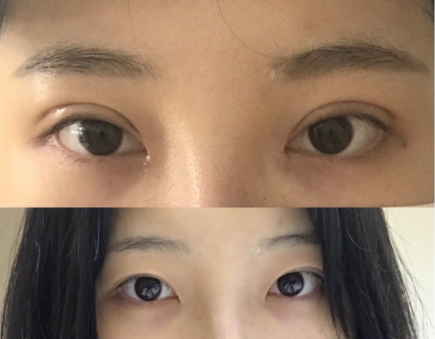 실밥 풀었어여!