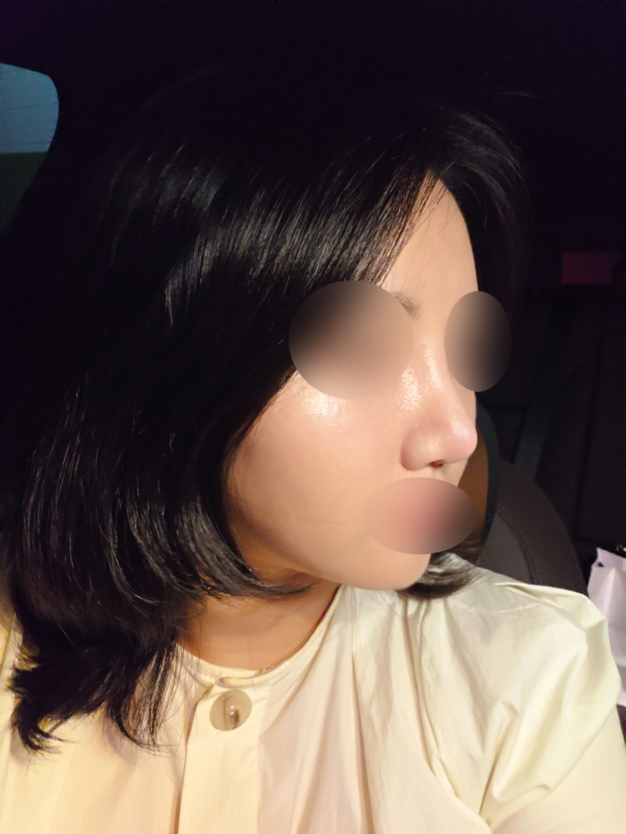자연스러운데 높은 콧대 원하시면 진짜 여기!! 선택에 후회 없을 거예요!!