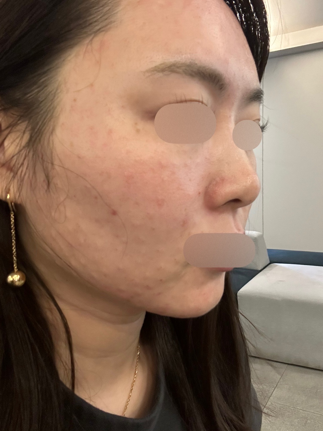 효과 좋아서 다른 곳에서 받다가 여기로 재방문했어요~