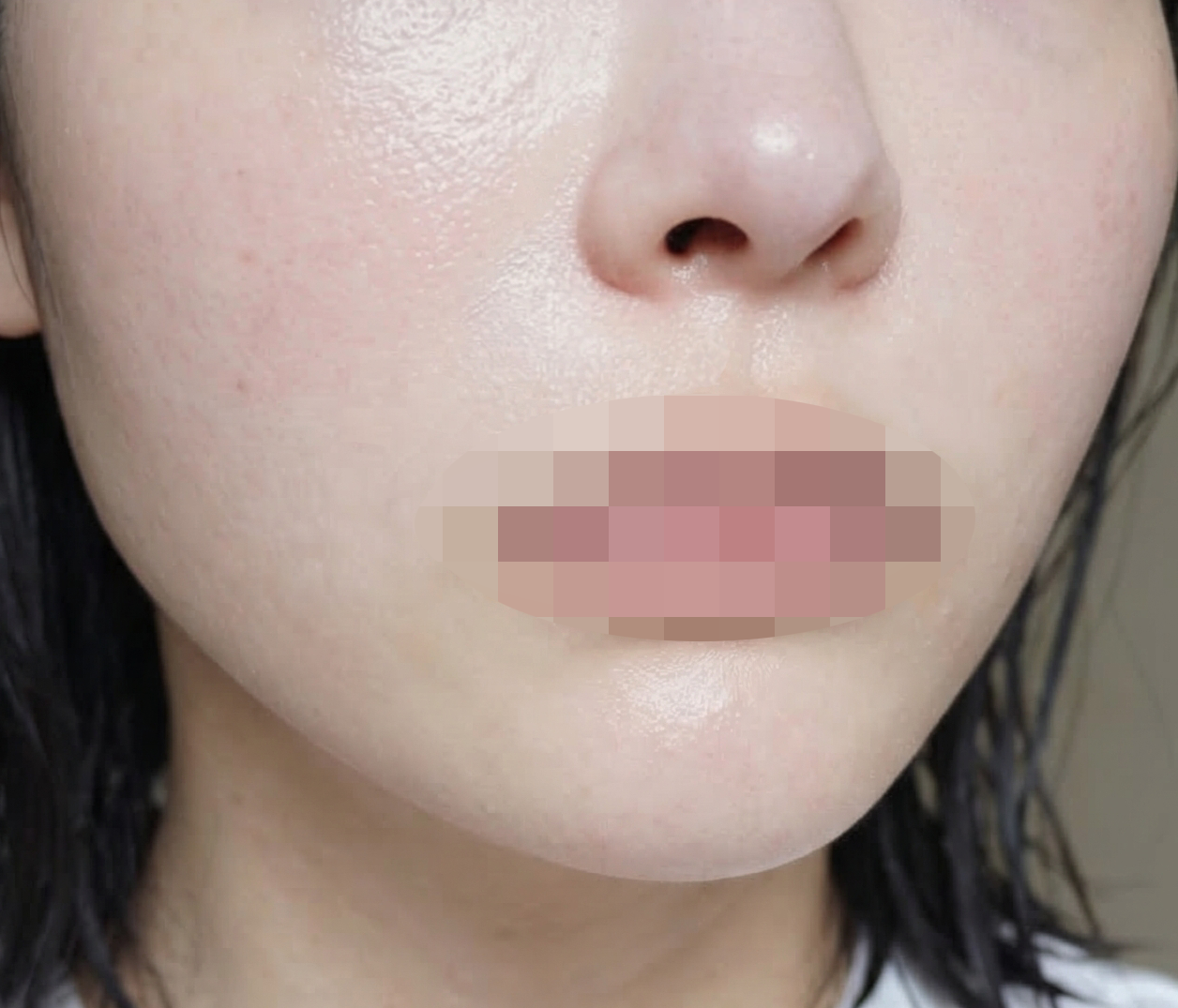 대기 시간도 짧고, 바로 턱선 정리되는 느낌이라 계속 다니려고요ㅎㅎ