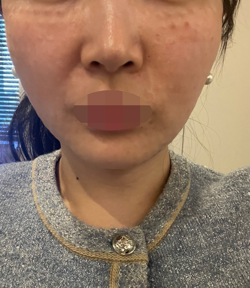 겨울이라 건조해서 받았는데 어플 가격 동일하고 수면이라 편하게 받았어요~꼼꼼하게 해주신 것 같네요ㅎㅎ