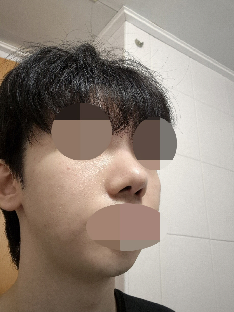코가 완벽하게 예뻐졌어요~