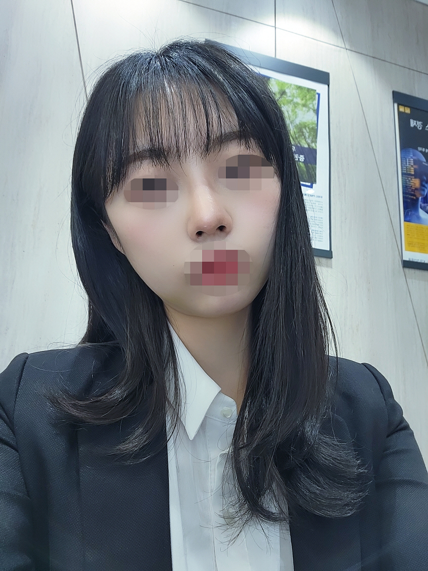 회복과정은 힘들었지만 결과는 성공이기때문에 감사하며 살아가려구해용