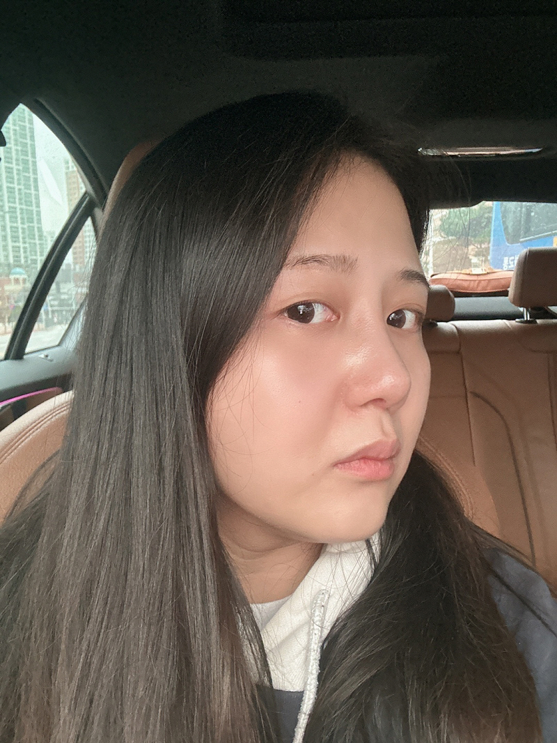 황정일 원장님 덕분에 편안하게 수술 들어간거 같아요. 결과는 만족합니다!