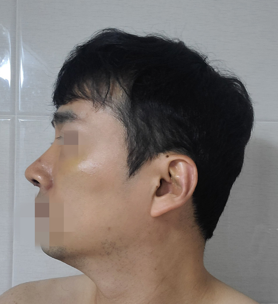 수술을 많이 해본 원장님만큼 수술을 잘하시는 분은 없다고 생각했습니다