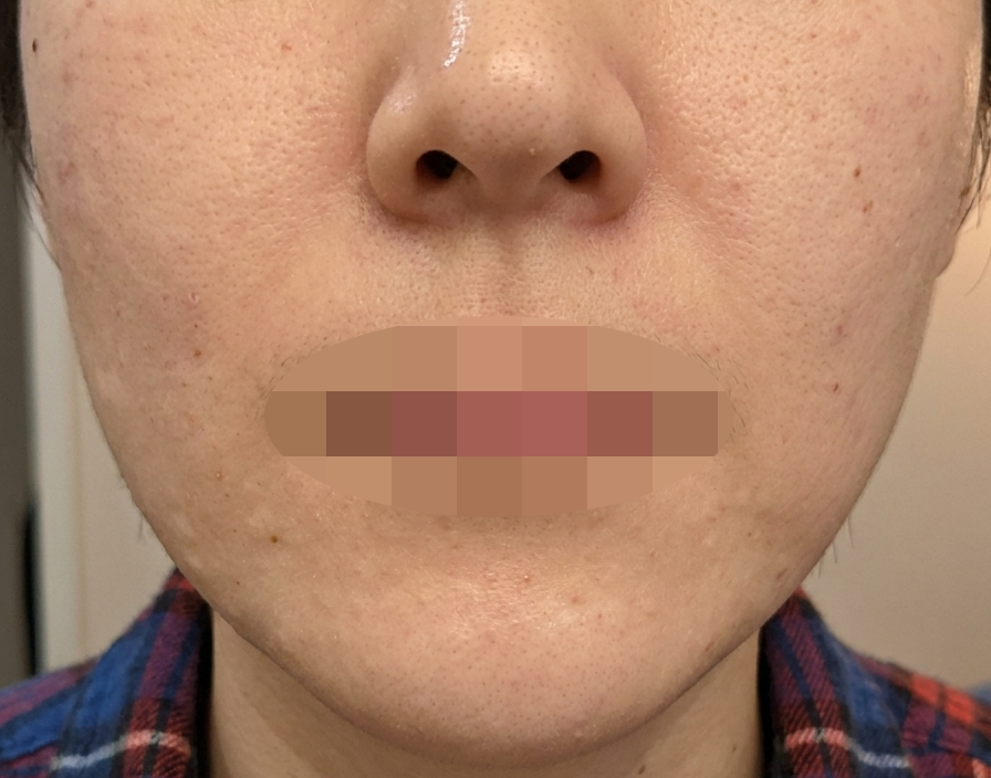 2일 차부터 속부터 느낌 다른 리쥬베룩, 받길 잘했습니다.