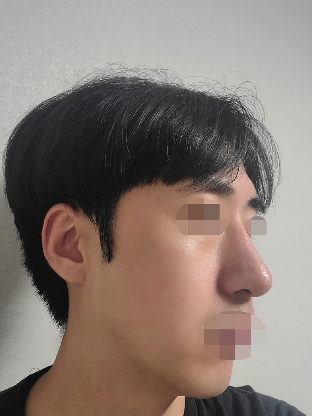 망설임없이 바로 진행했는데 결과 너무 만족스러워요!
