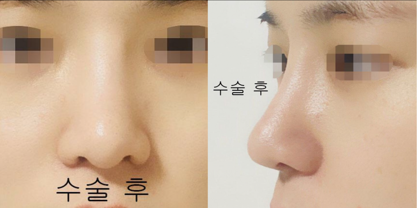 복코후기