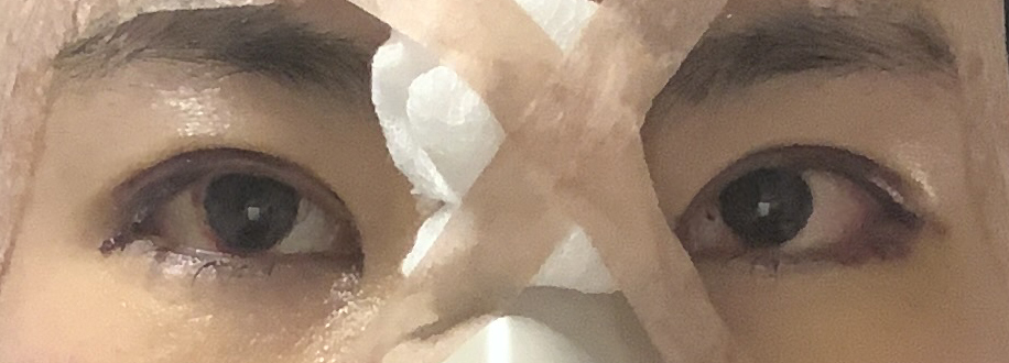 눈코지 후기예욥