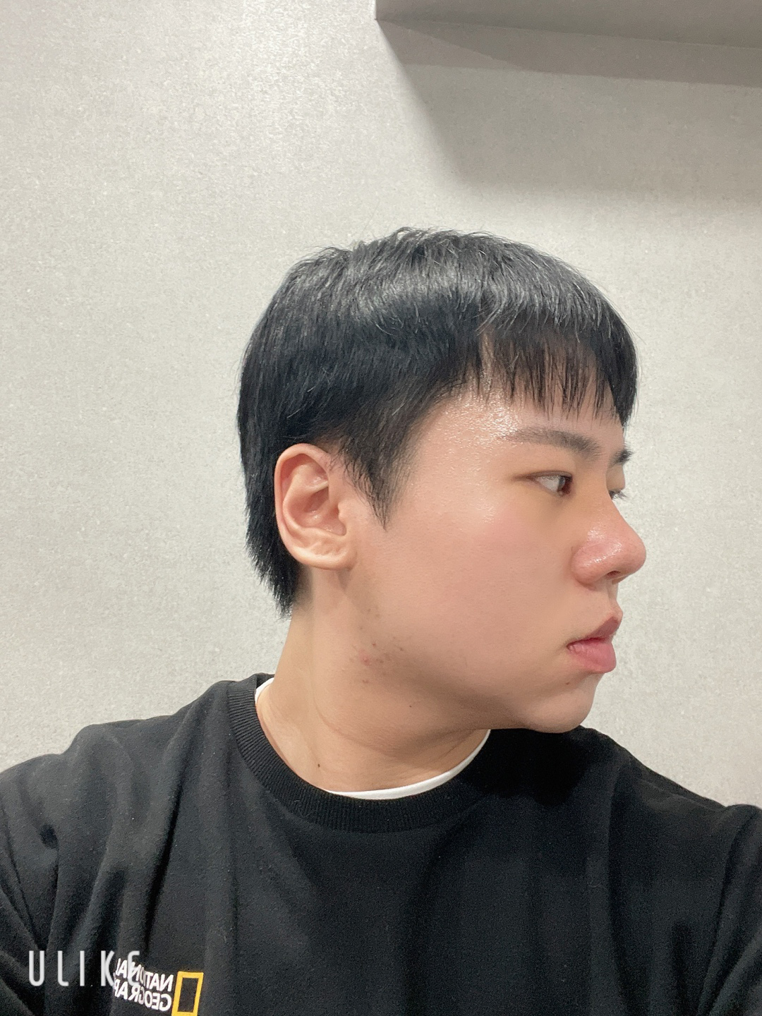 정말 만족스러운 수술이였습니다