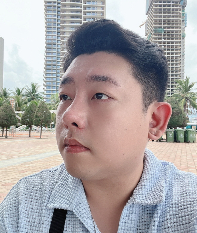 얼굴형에 잘 맞게 세련된 코 라인이 잡혀서 주변에서도 인상이 훨씬 좋아졌다고 하네요
