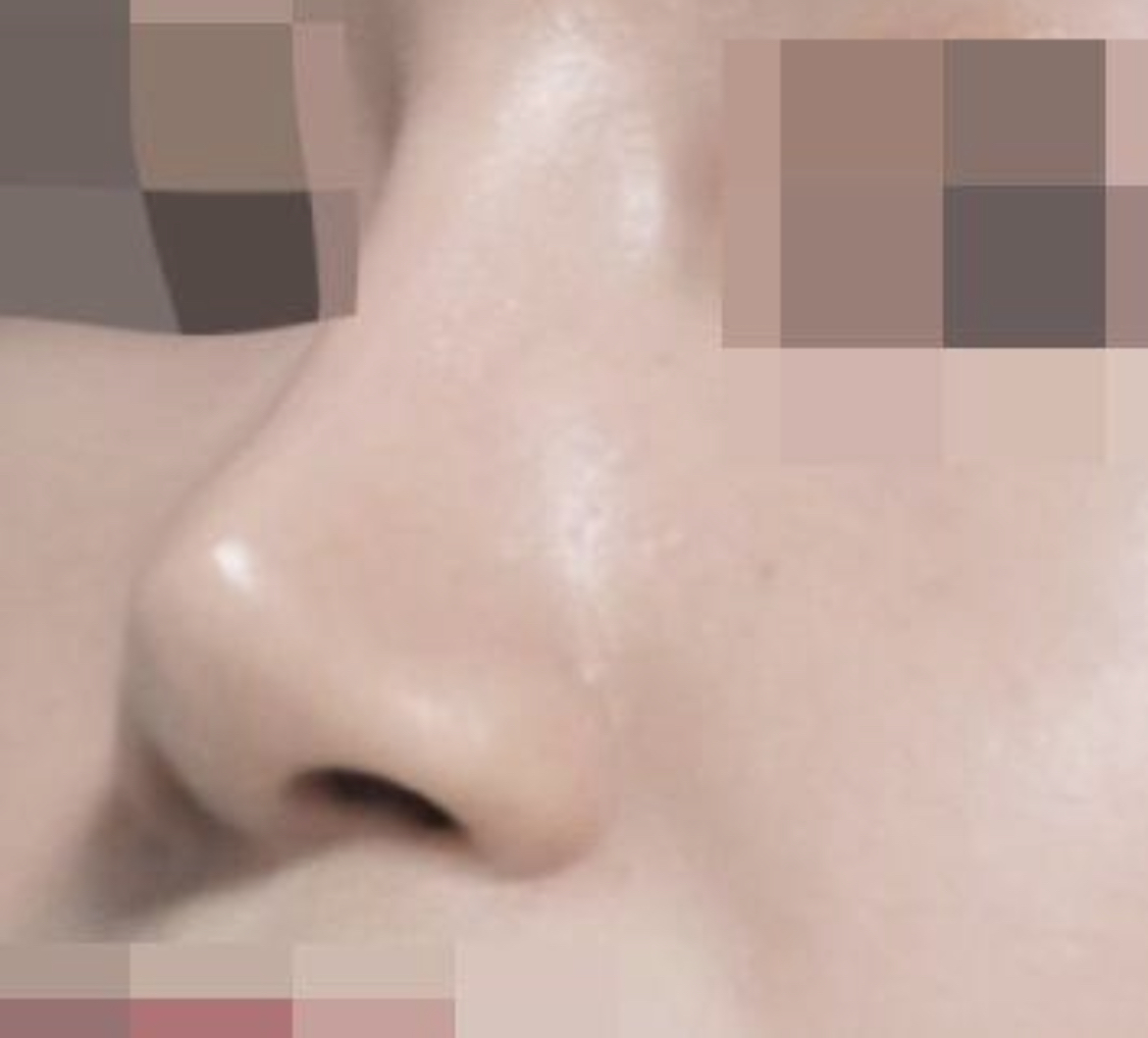 예쁜 코 만들어 주셔서 감사합니다 ~