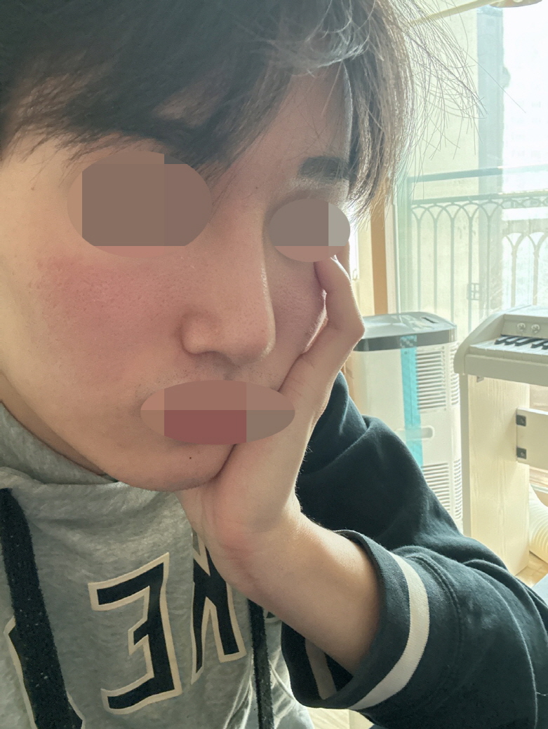 잘 수술해주셔서 결과가 대박입니다^^!